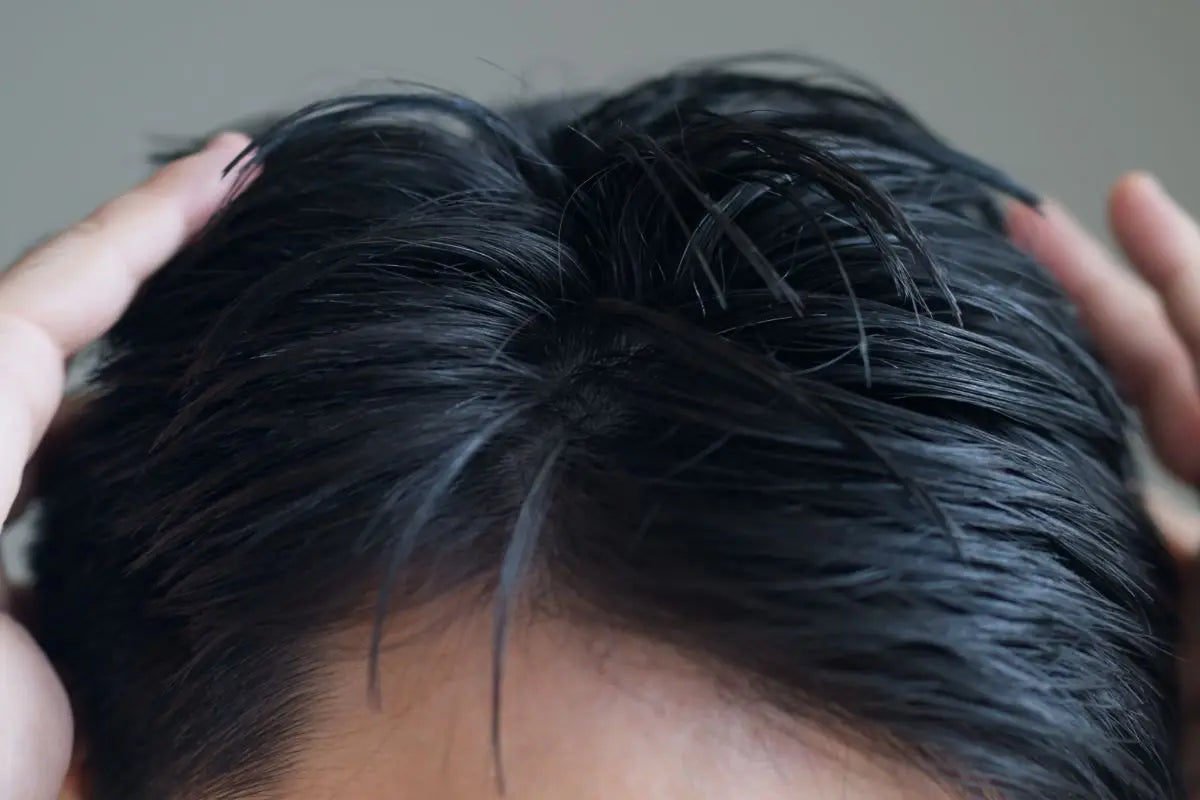 Capelli grassi: sintomi cause e rimedi