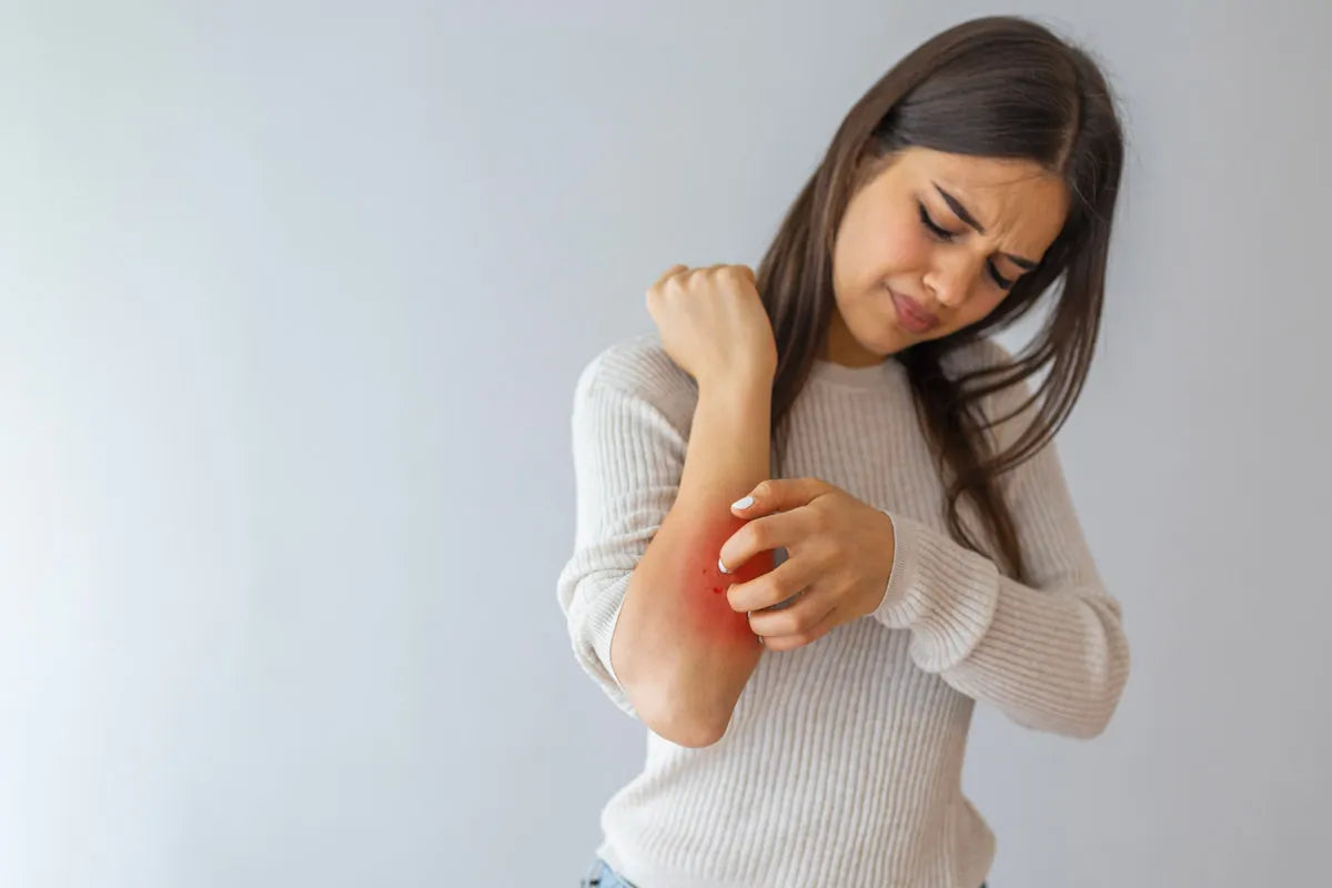 Psoriasi: sintomi, cause e rimedi