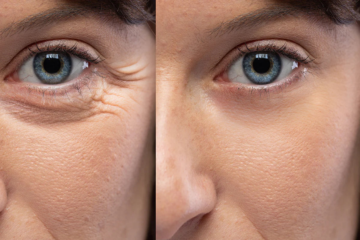 Curare la pelle con alimentazione e integratori