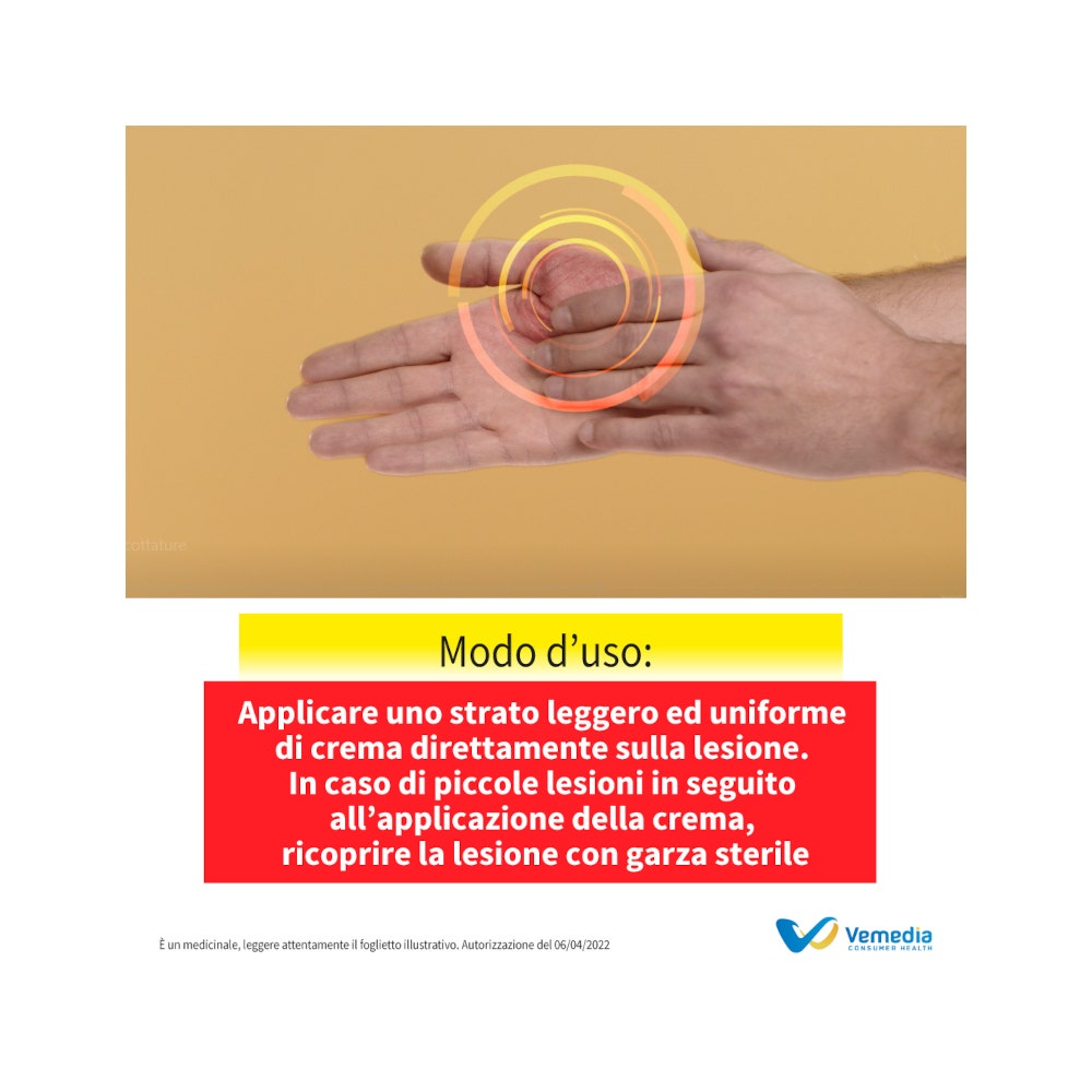 Foille Crema per ustioni, bruciature e scottature domestiche 29,5 g-7