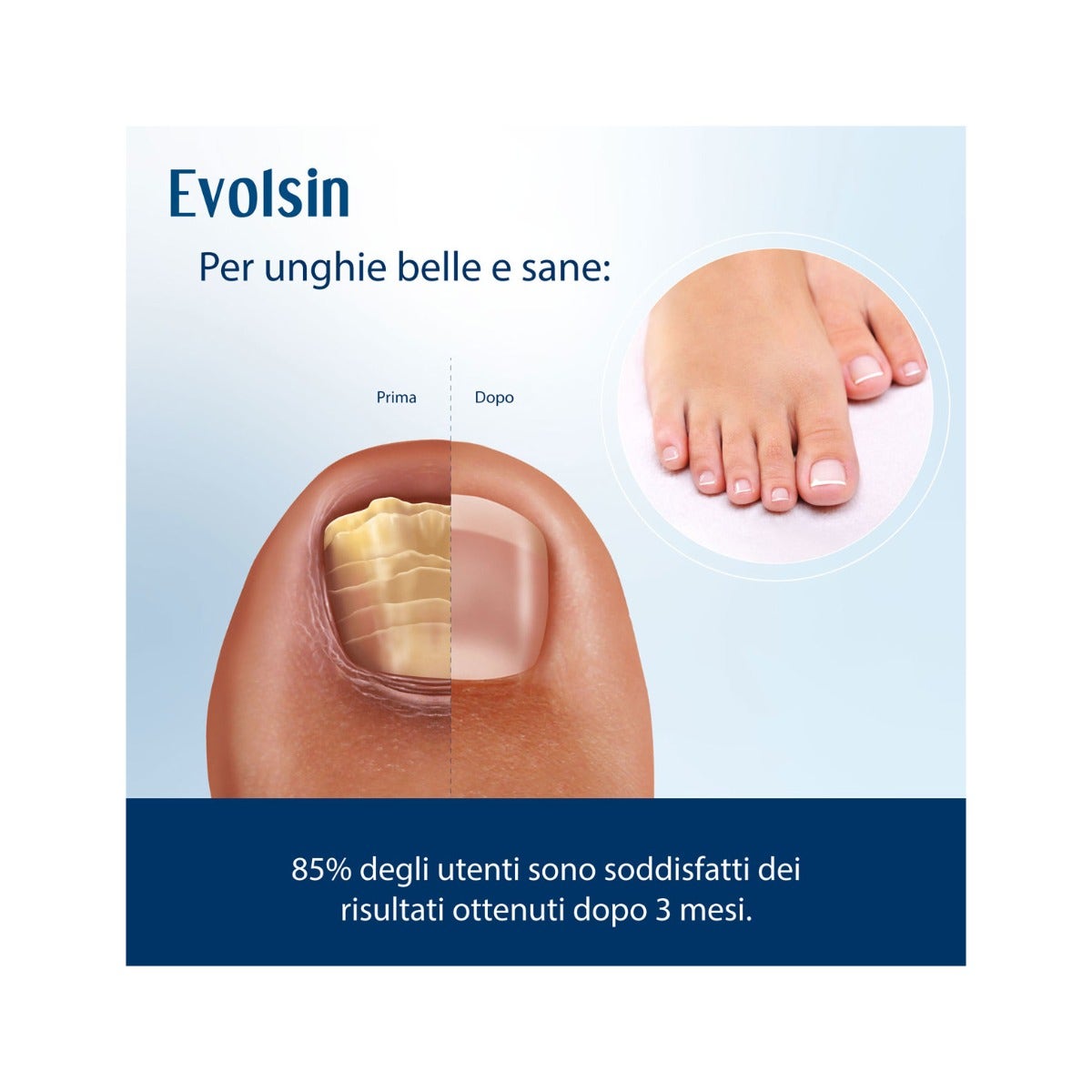 Evolsin Liquido Antimicotico per Unghie 10ml-10