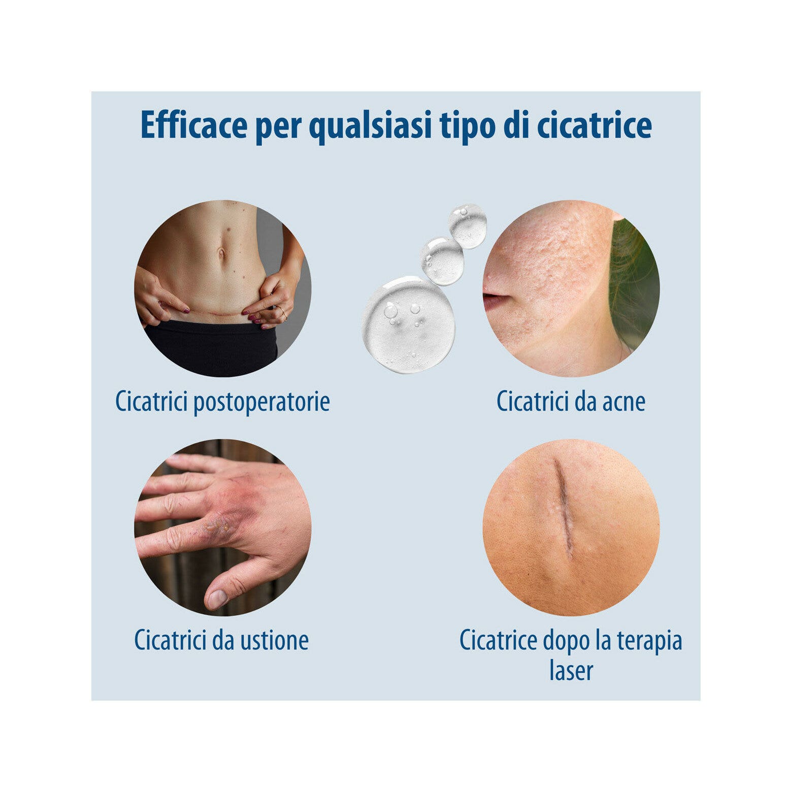 Evolsin Gel Silicone Per Cicatrici Per Bambini E Adulti 20g-3