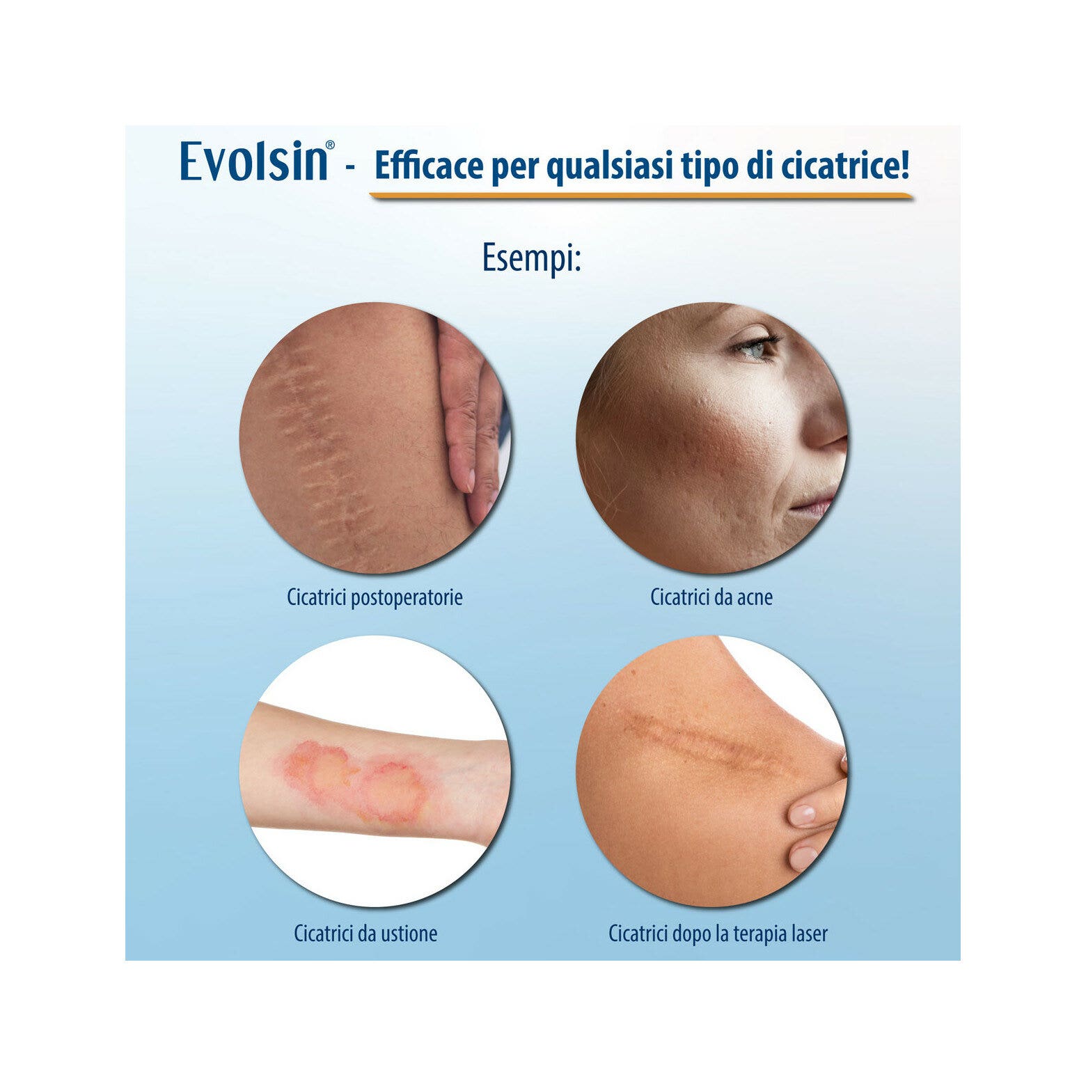 Evolsin Cerotto Trasparente per Cicatrici Di Ogni Tipo-6