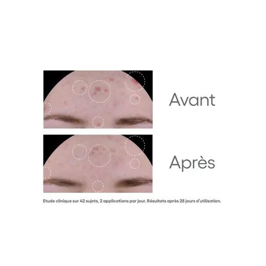 A-Derma Biology Ac Trattamento Opacizzante Anti-imperfezioni 40ml-10