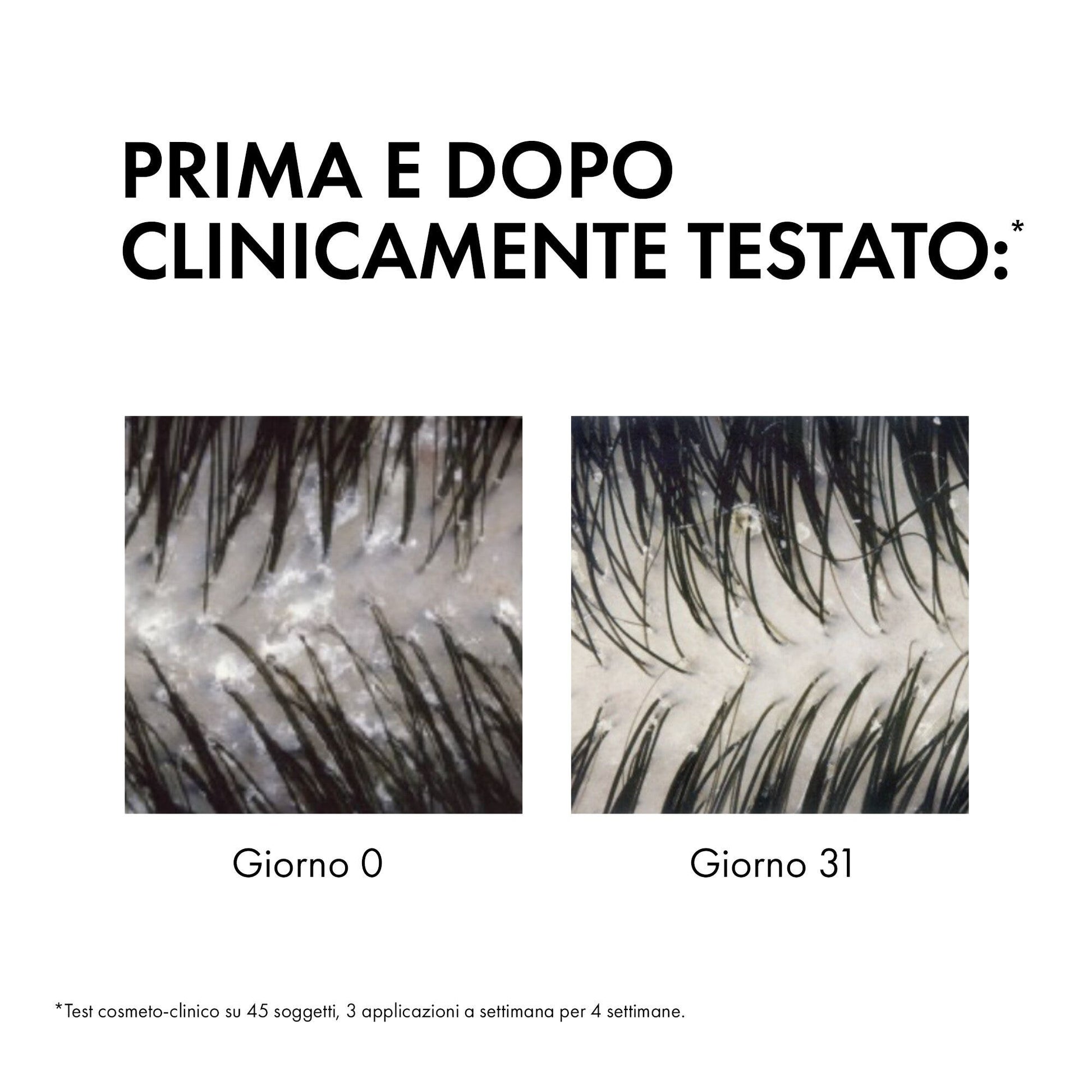 Vichy Dercos Shampoo Antiforfora capelli da normali a grassi 390 ml-6