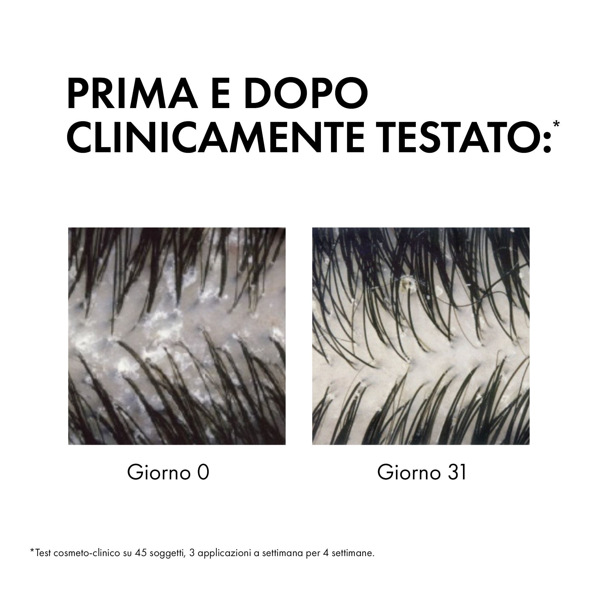 Vichy Dercos Shampoo Antiforfora capelli da normali a grassi 390 ml-6