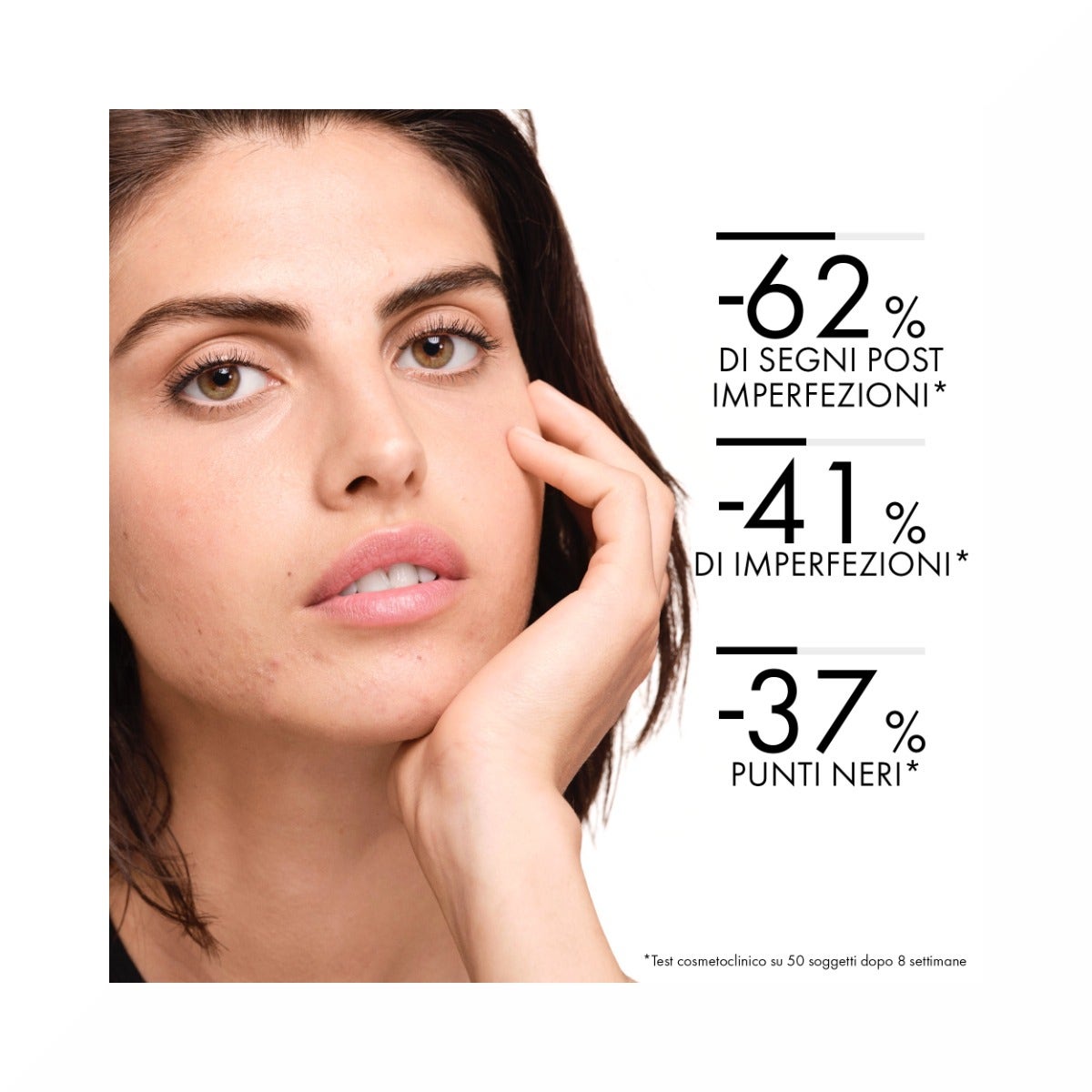 Vichy Normaderm Trattamento Idratante Doppia Azione 50ml-25