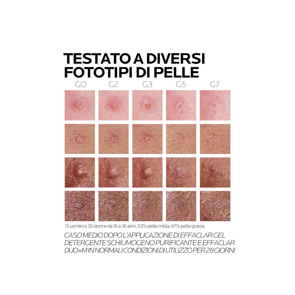 La Roche Posay Effaclar Duo+M Trattamento Viso Anti-Imperfezioni 40ml-5