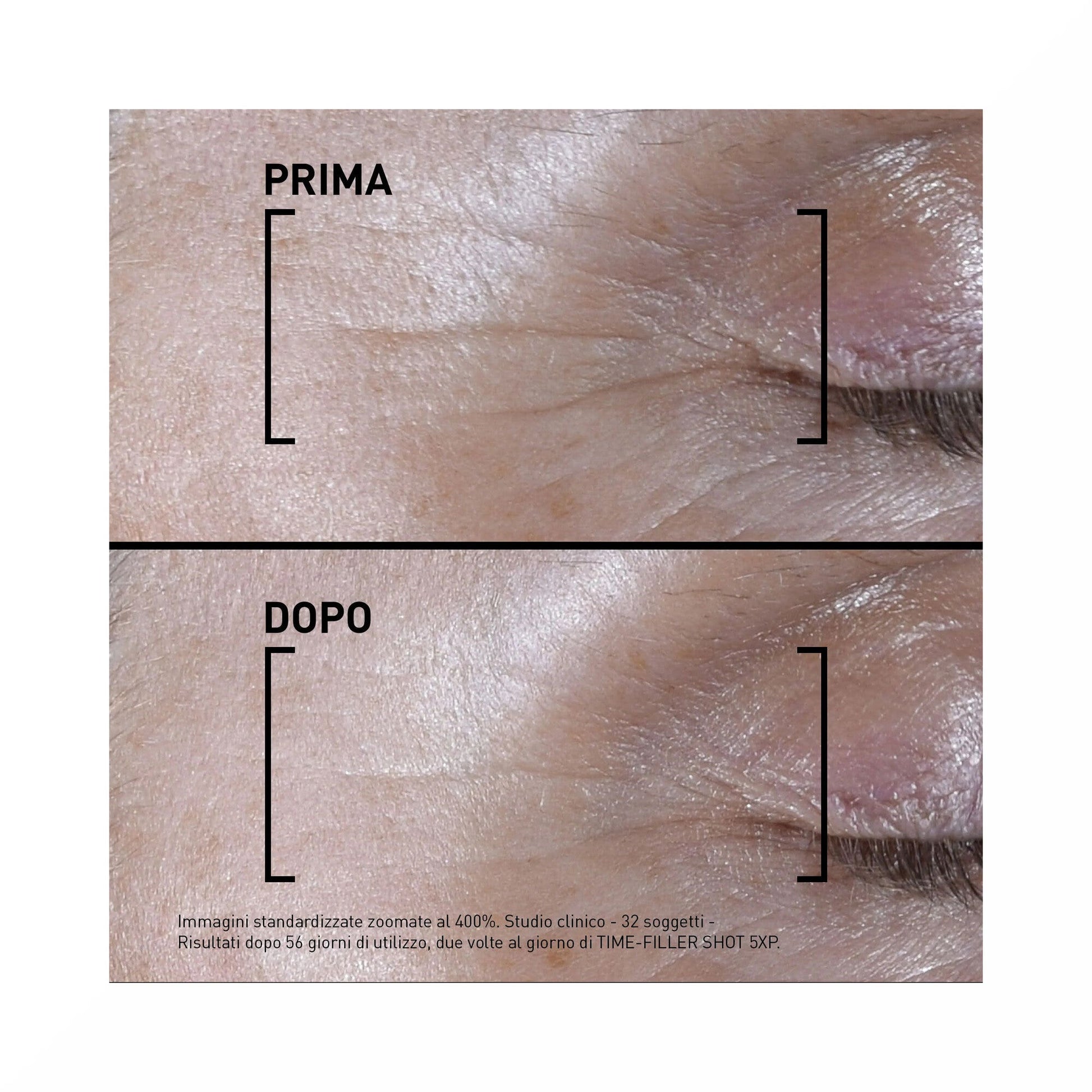 Filorga Time Filler Shot 5xp Siero Concentrato Linee Di Espressione 15ml-4