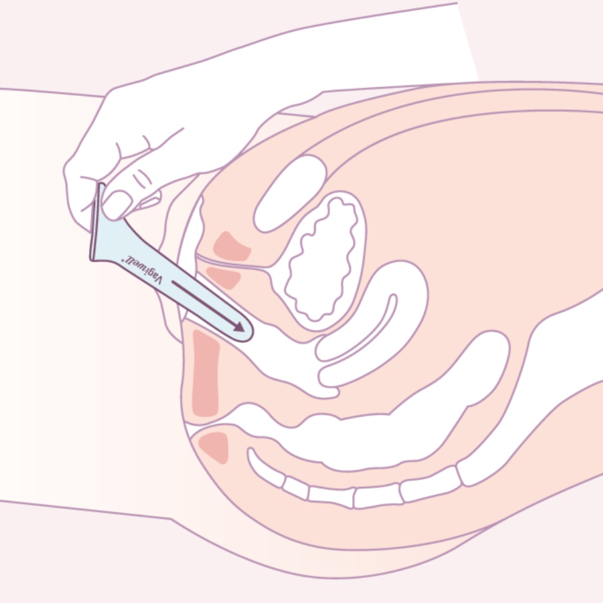 Vagiwell Dilatatore Vaginale Misura 5-2