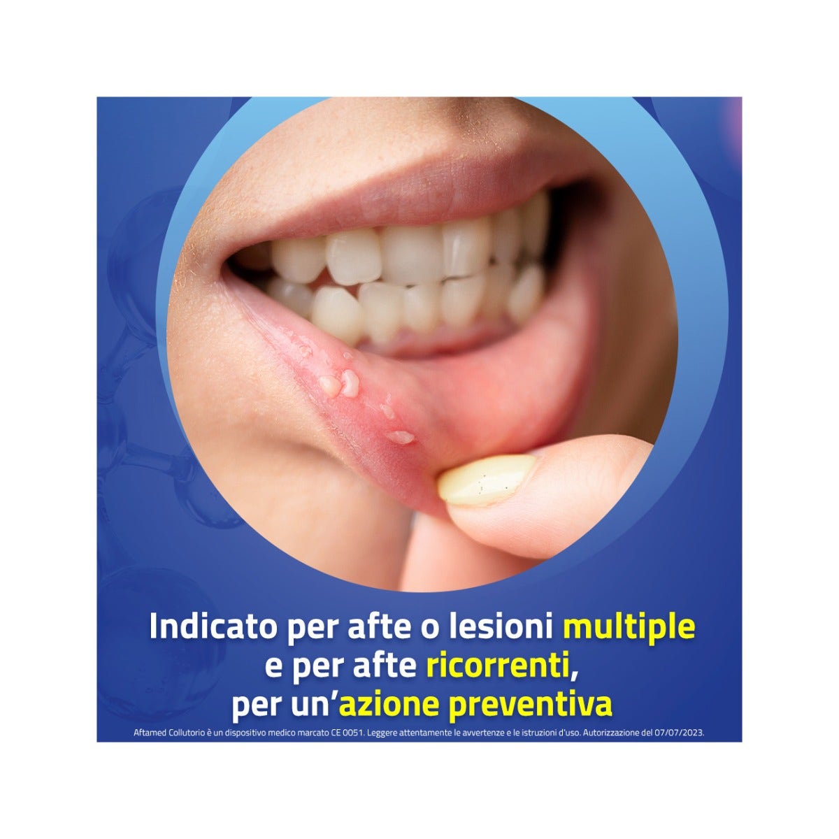 Aftamed Collutorio 150ml-6