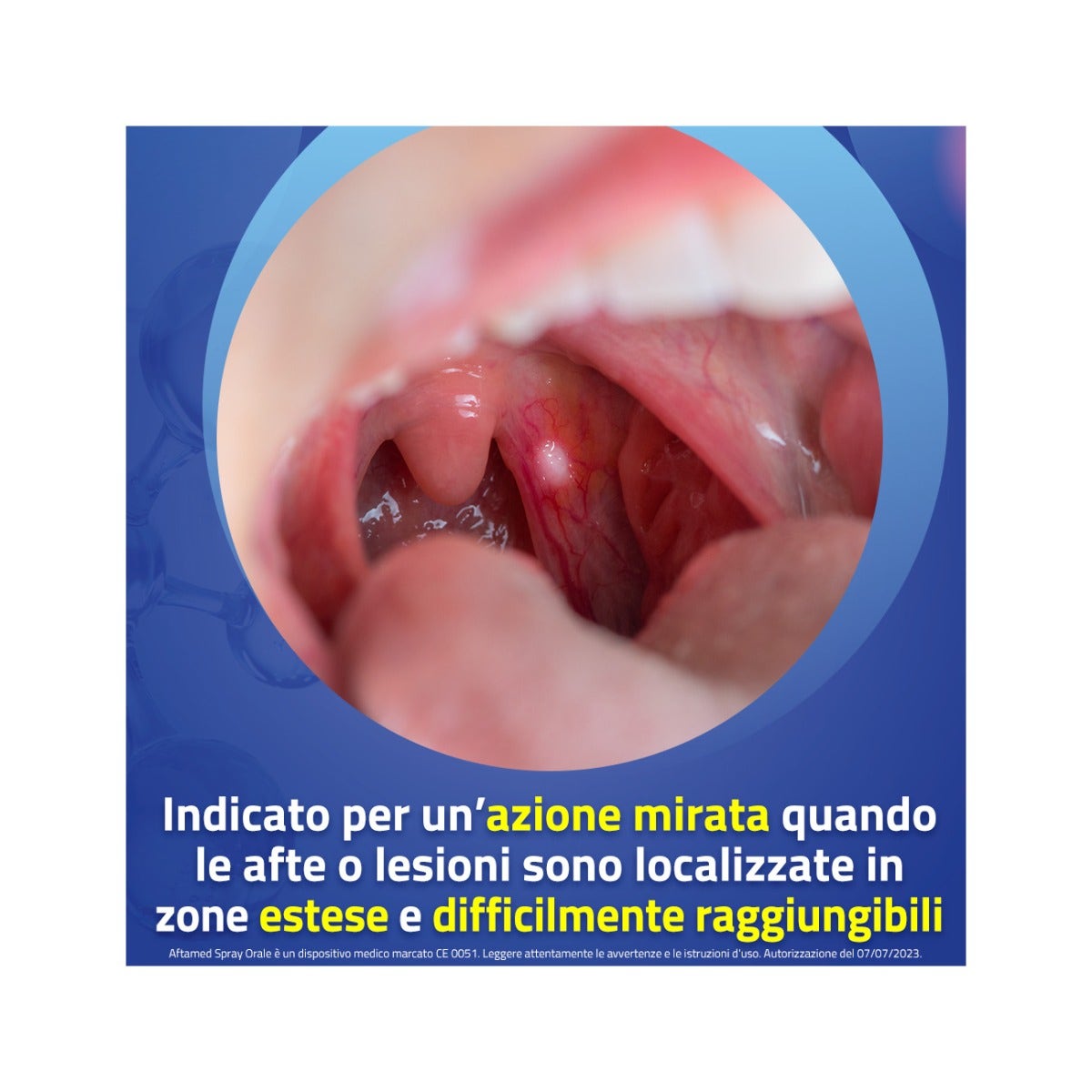 Aftamed Spray Orale 20ml-8