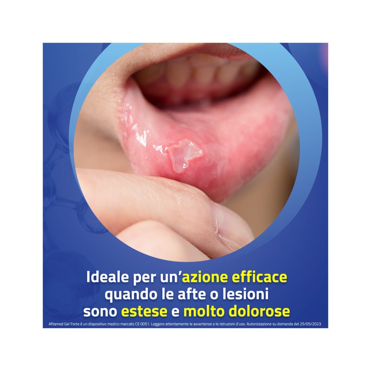 Aftamed Forte Gel Orale ad Alta Intensità 8ml-6