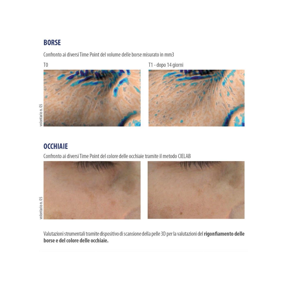 Helan Ireos Contorno Occhi Siero Gel Liftante Illuminante Antiborse Antiocchiaie 10ml-3