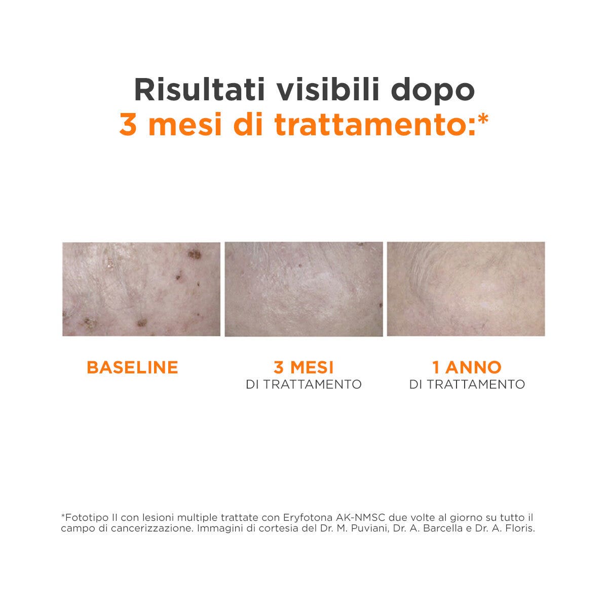 ERYFOTONA AK-NMSC FLUID 50ML-4