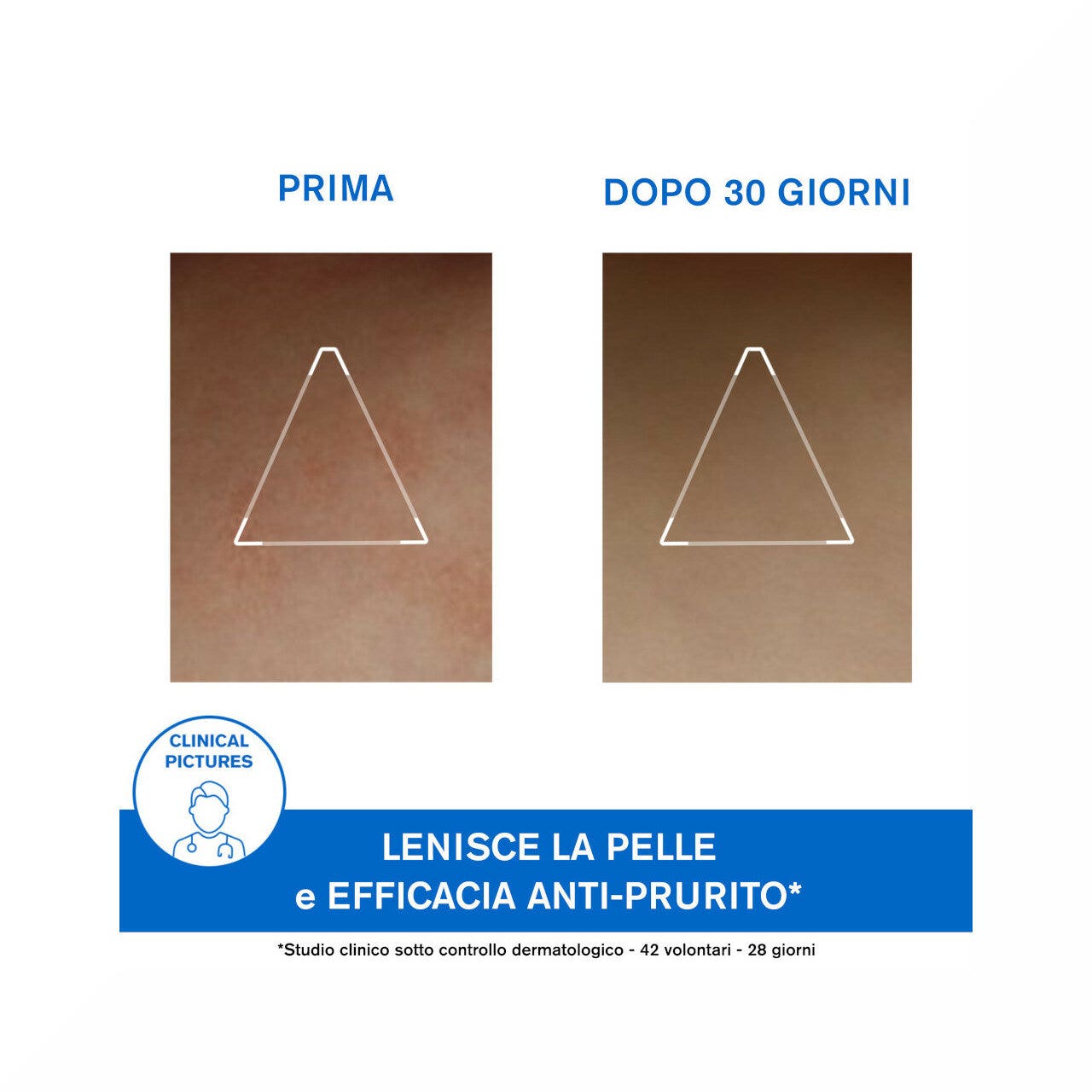 Uriage Xemose Cerato Anti-Irritazioni 200 ml-8