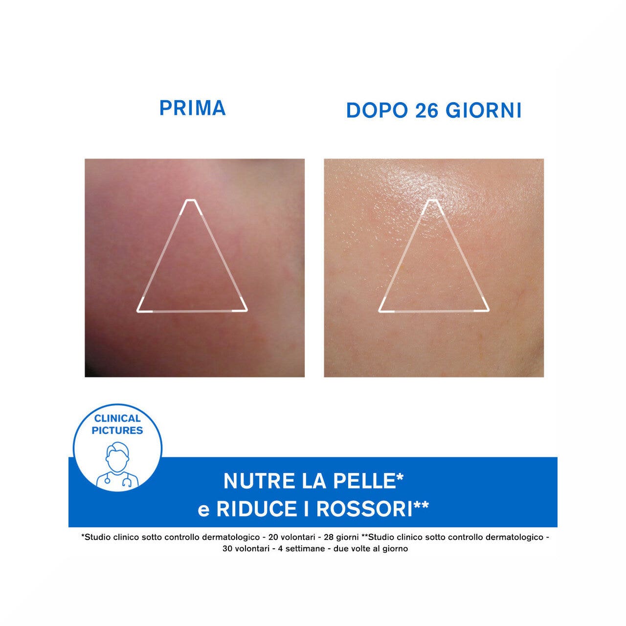 Uriage Xemose Crema Viso 40ml-9