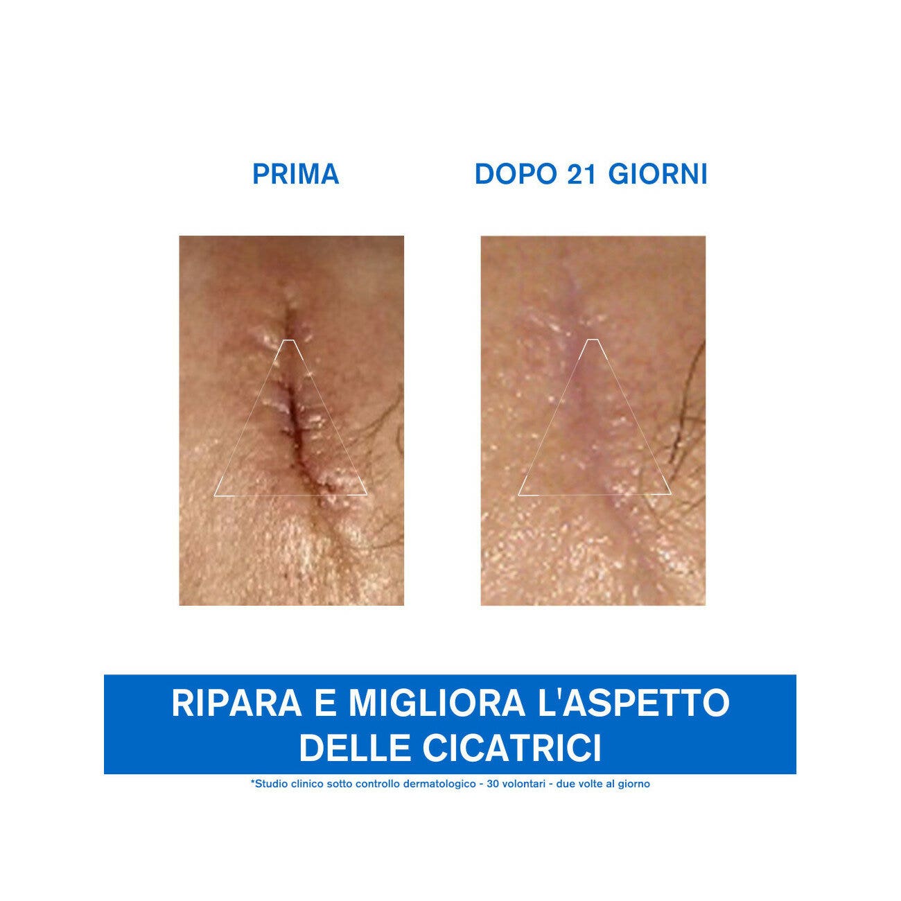 Uriage Bariederm Cica-Crema 40ml-9