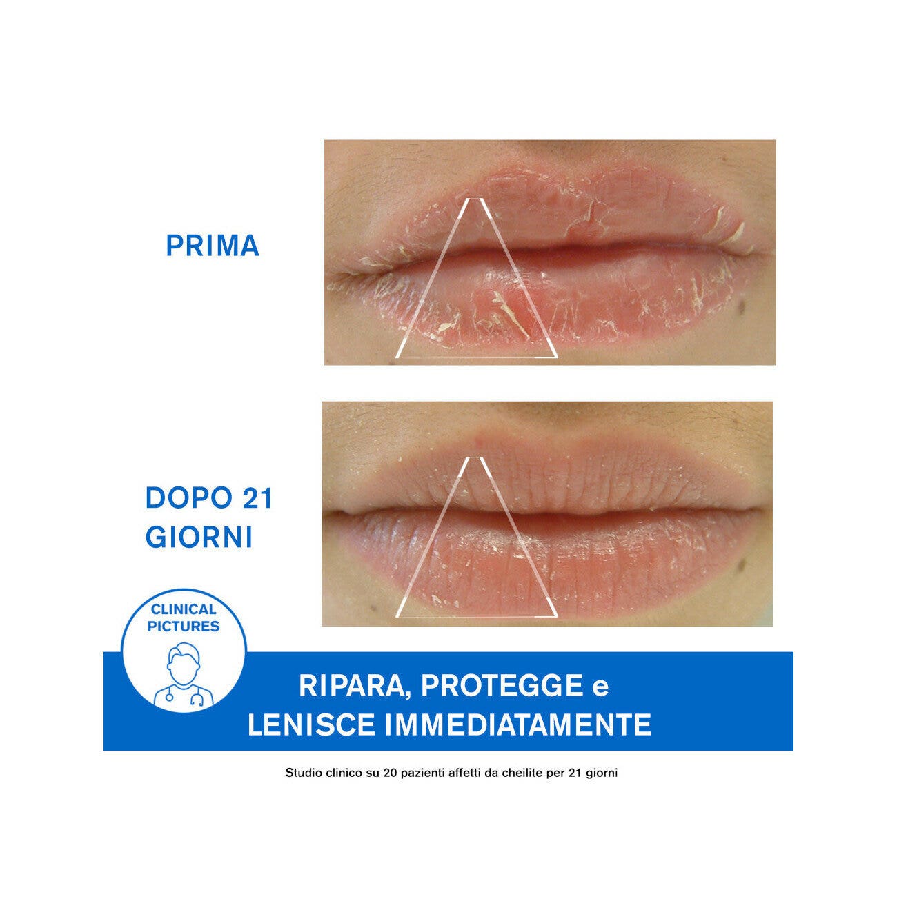 Uriage Bariederm Cica-Levres Crema Protettiva Labbra 15ml-9