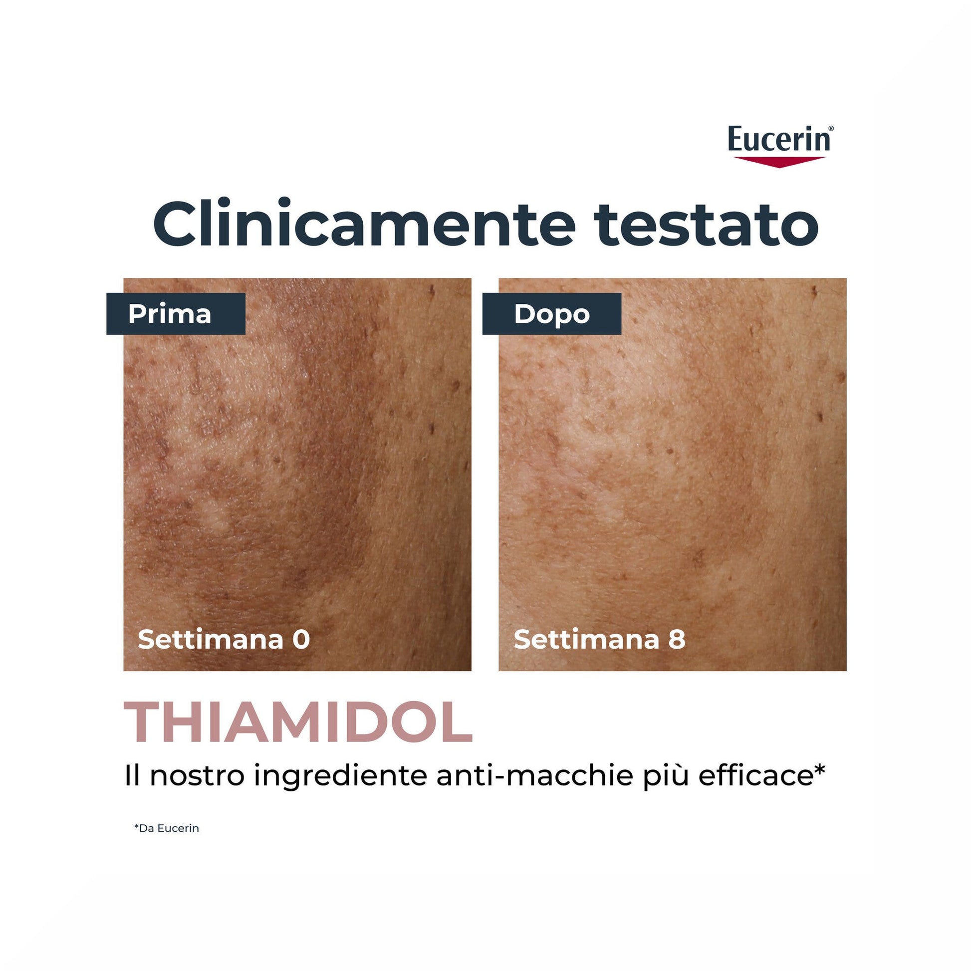 Eucerin Anti-Pigment Correttore 5ml-3