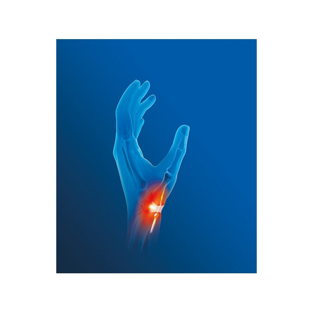 Epitact Querv'Activ Tendinite Del Pollice Taglia M Mano Destra-3