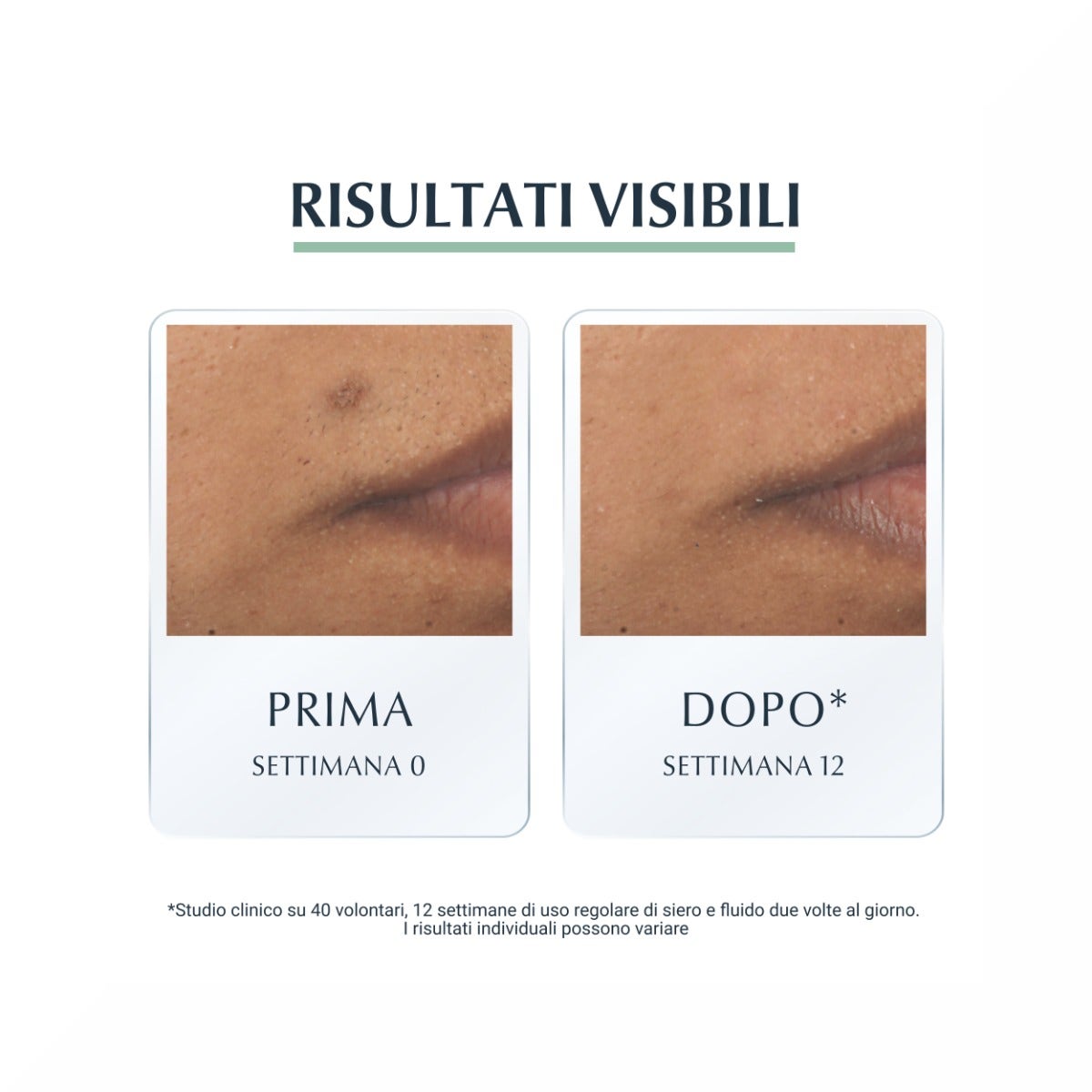 Eucerin Dermopurifyer Oil Control SPF 30 Fluido Protettivo 50ml-4