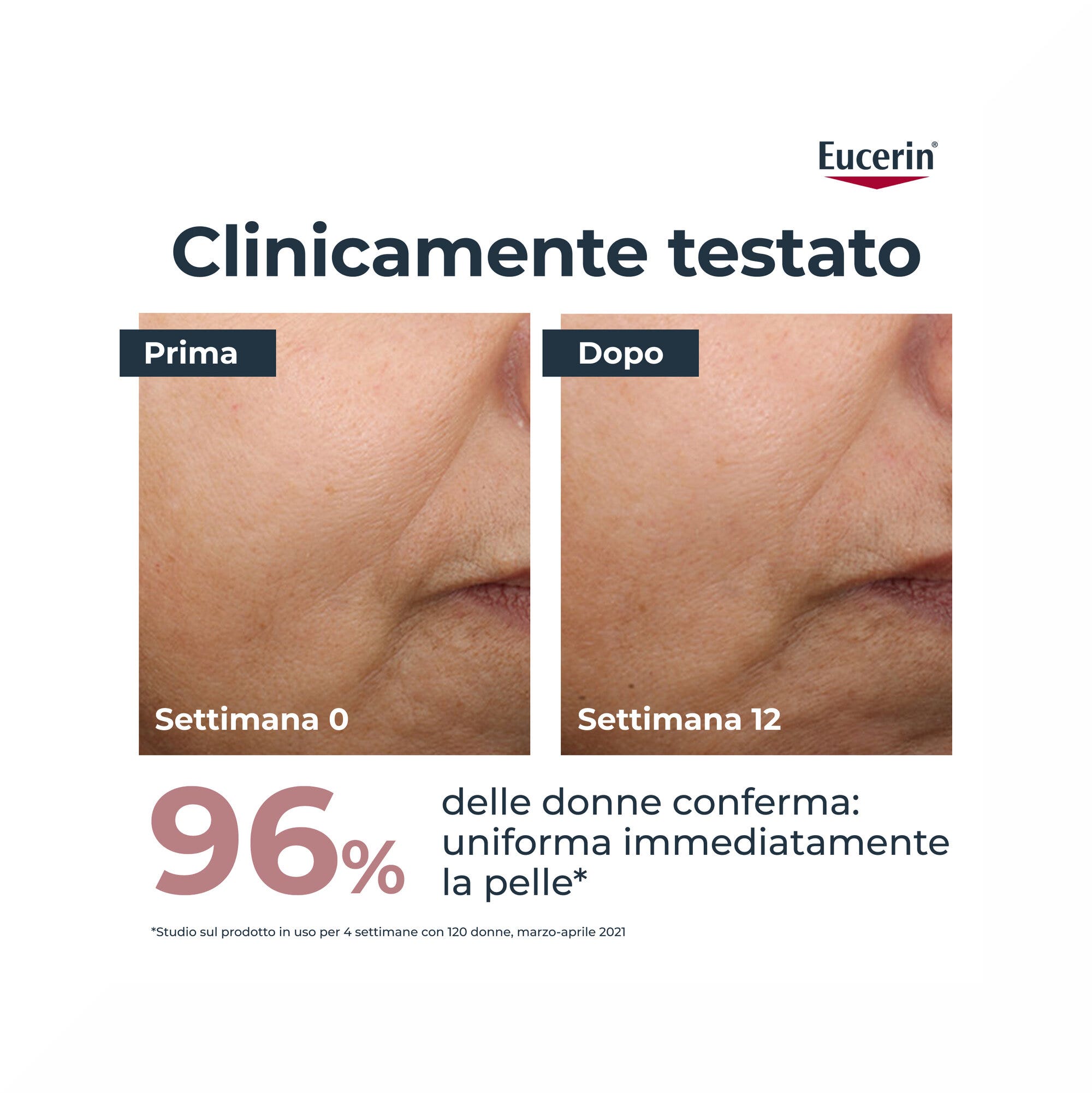 Eucerin Anti-Pigment Crema Giorno SPF 30 Colorata Medium 30ml-3