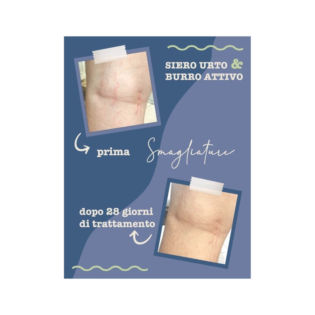 La Saponaria Siero Urto Smagliature 100ml-4