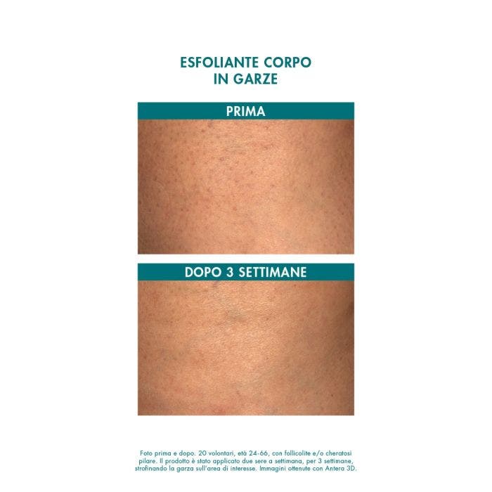 Miamo Alpha Blend 13% Esfoliante Corpo Garze Imbevute 6 Bustine-2