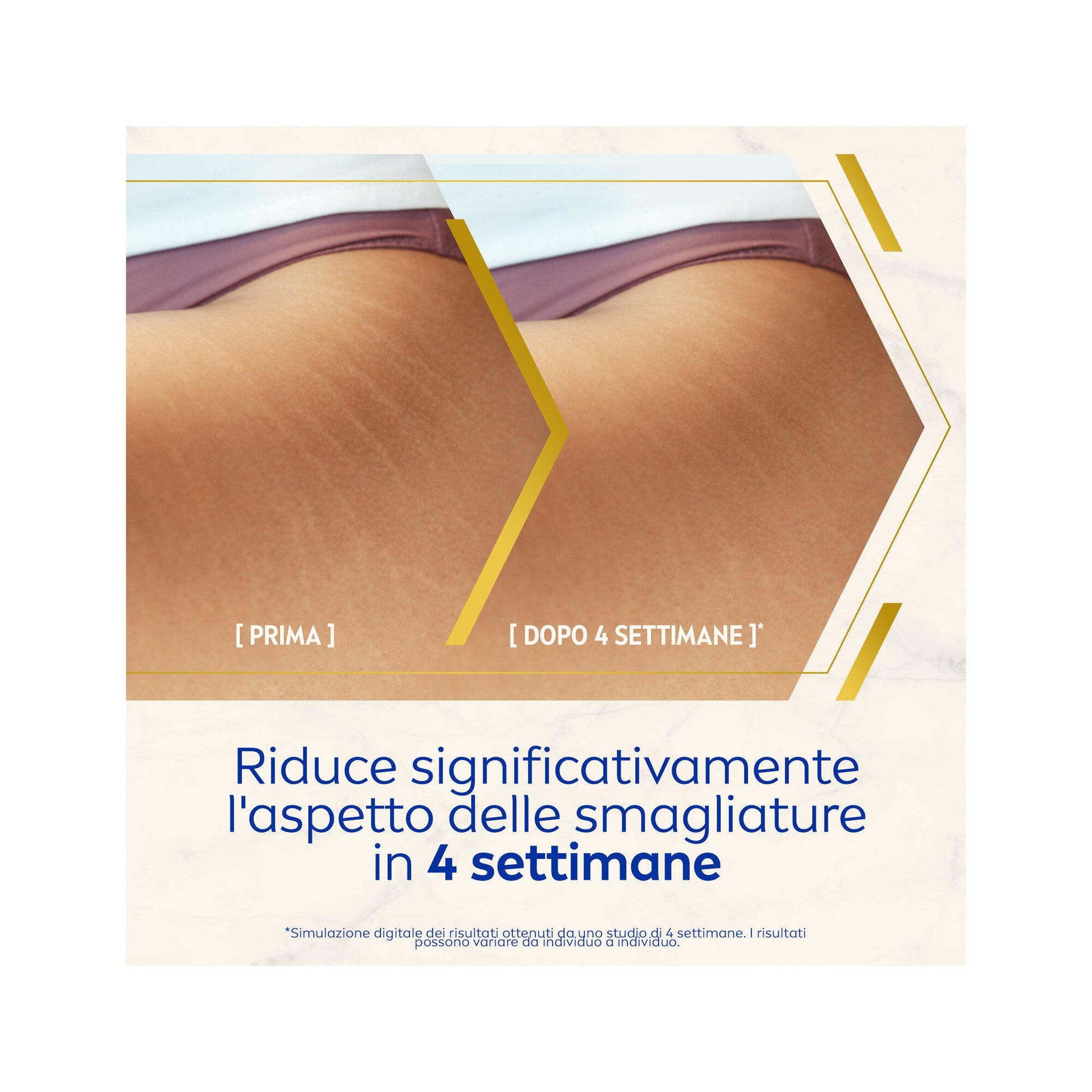 Nivea Luminous630 Olio-siero Corpo Antismagliature 100 ml Olio Per La Cura Corpo Antismagliature-4