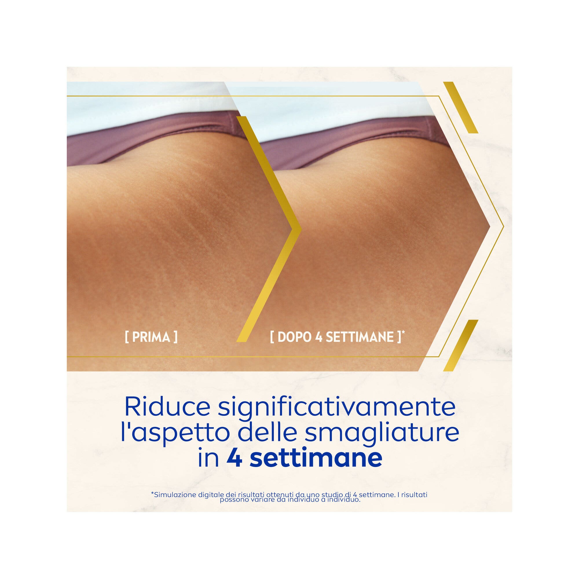 Nivea Luminous630 Olio-siero Corpo Antismagliature 100 ml Olio Per La Cura Corpo Antismagliature-4