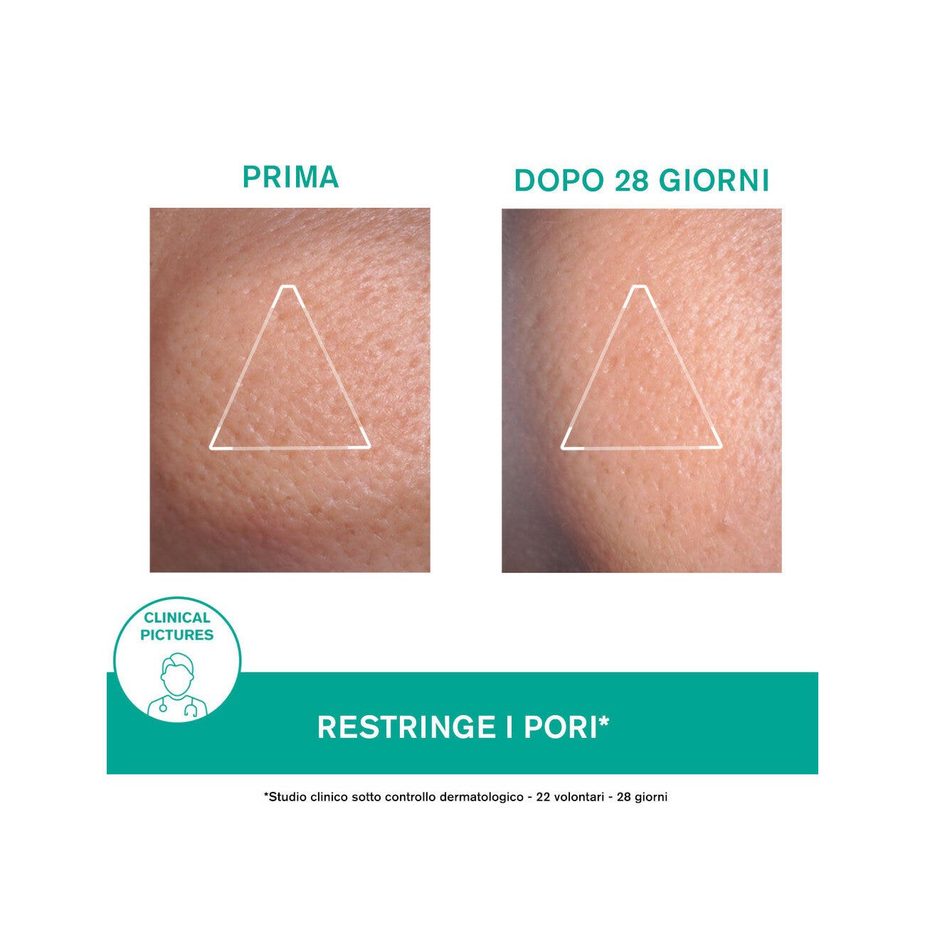 Uriage Hyséac Mat Crema 40ml-4