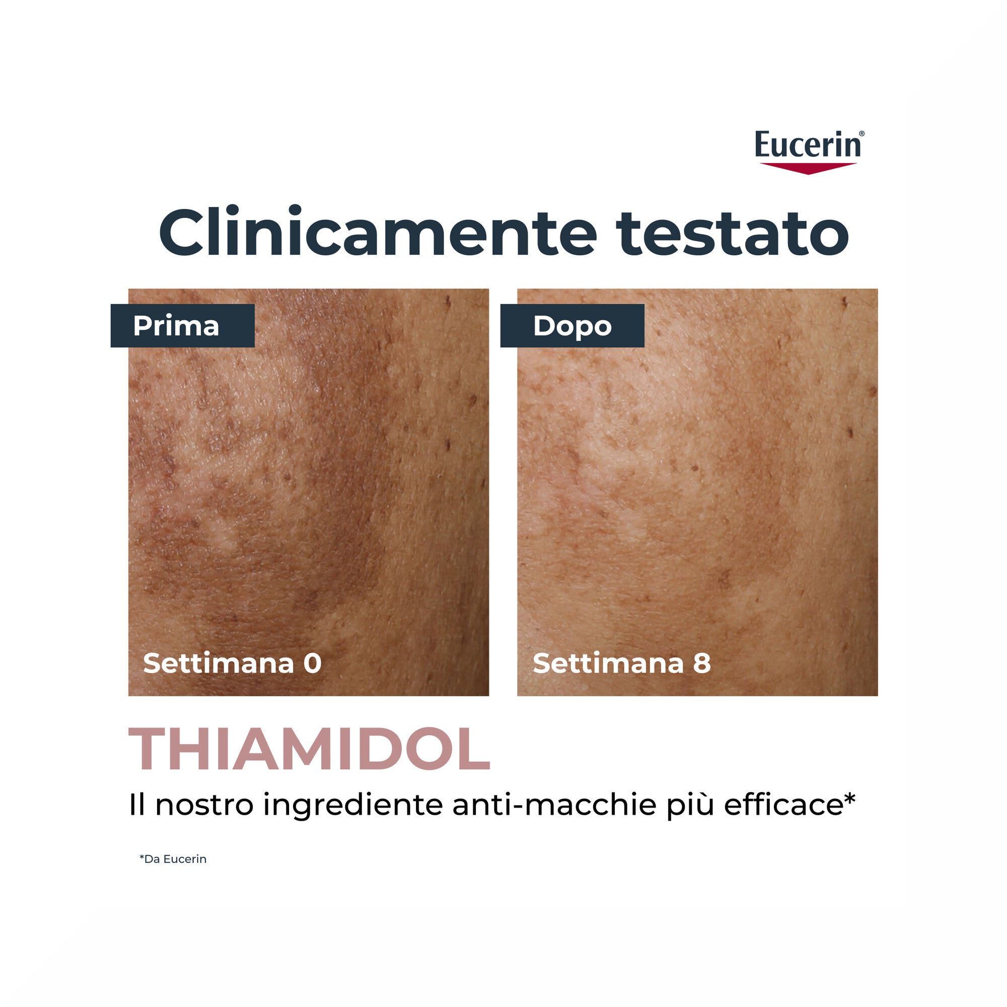 Eucerin Anti-Pigment Siero Illuminante Anti-Macchie 30ml-3