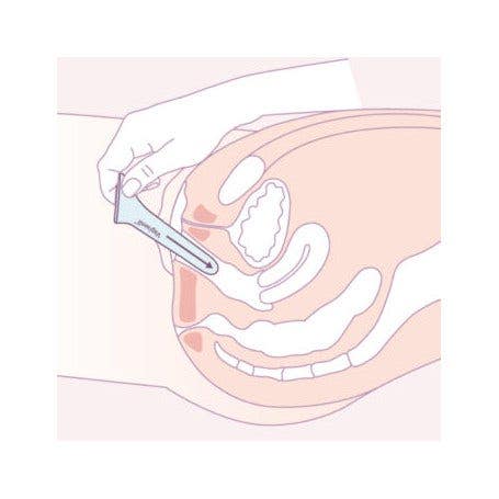 Vagiwell Set Dilatatori Vaginali In Silicone 3 Pezzi Large-4