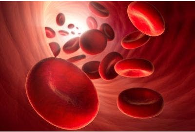 anemia