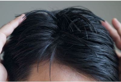 capelli