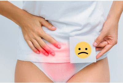 Cinque integratori per curare la cistite