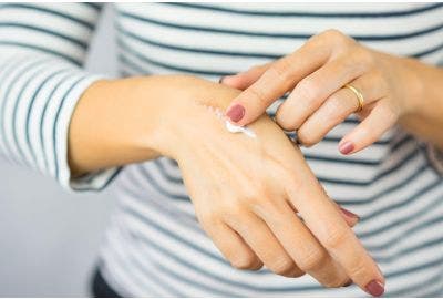 Come curare le cicatrici? I nostri consigli