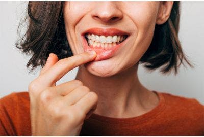 Gengive infiammate: cause e rimedi