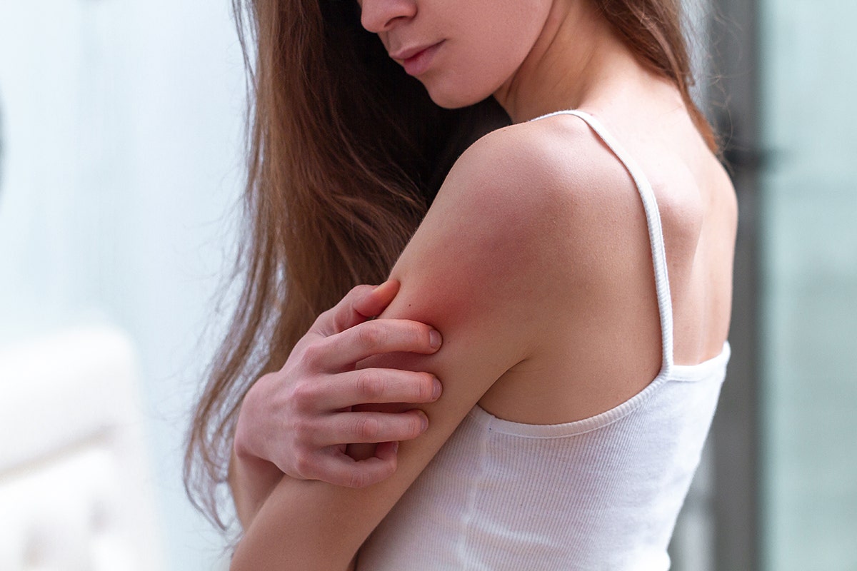 Tenere sotto controllo i disturbi della dermatite atopica: ecco come calmare il prurito