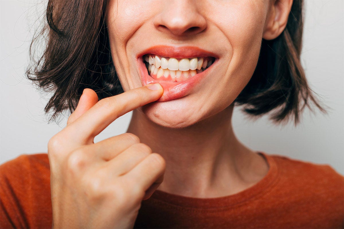 Gengive infiammate: cause e rimedi